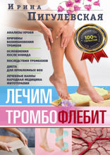 Лечим тромбофлебит. 100% гарантия улучшения  состояния ваших вен