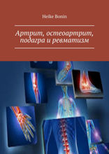Артрит, остеоартрит, подагра и ревматизм