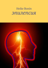 Эпилепсия