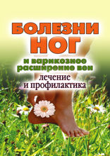 Болезни ног и варикозное расширение вен. Лечение и профилактика